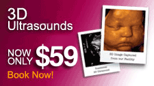 3D 4D Ultrasounds for $59