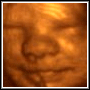 3D Ultrasound Photo of Client's Baby