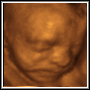 View 3D Ultrasound Photo of Client's Baby