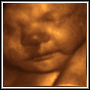 View 3D Ultrasound Photo of Client's Baby