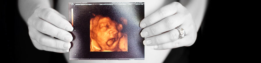 3D/4D Ultrasound Packages in Orlando