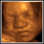 View 3D Ultrasound Photo of Client's Baby